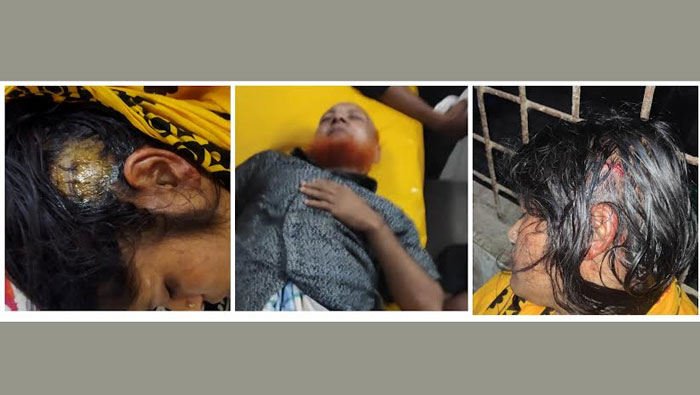 দু&rsquo;গ্রুপের সংঘর্ষে নারীসহ ৪ জন আহত