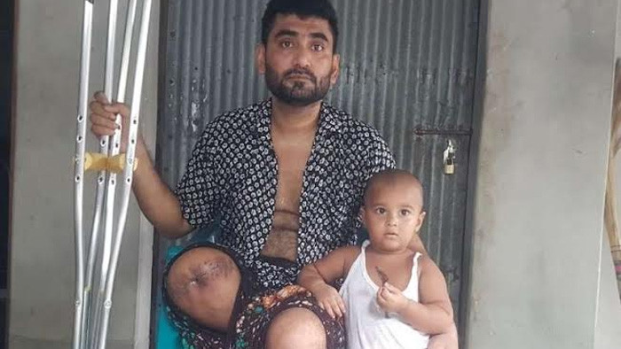 পুলিশের গুলিতে পা হারিয়ে এখন চাকুরী হারালো ইমরান