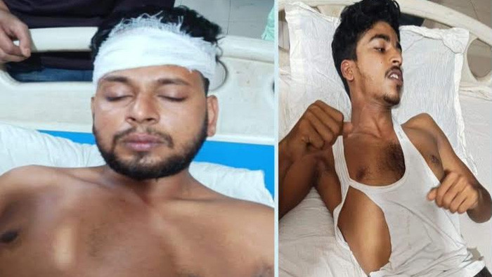 ঝিকরগাছায় দুই ছাত্রদল নেতার ওপর হামলা, কুখ্যাত সন্ত্রাসী রজব আলীর পক্ষ নিয়েছেন ওসি