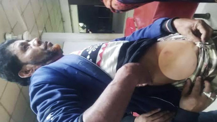 নোয়াখালীতে মোটরসাইকেলে এসে প্রকাশ্যে কৃষককে গুলি