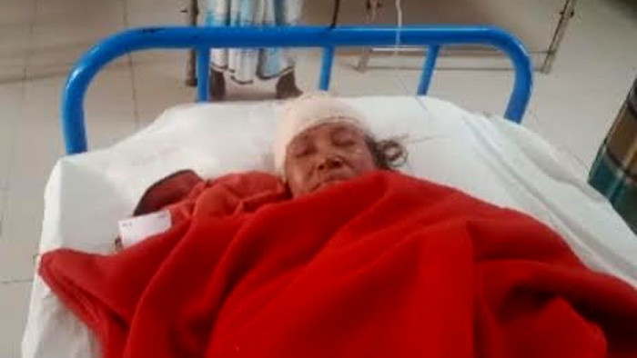 গাছ কাটাকে কেন্দ্র করে স্বামী স্ত্রীকে কুপিয়ে জখম