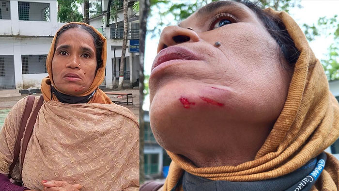 যুব উন্নয়ন কর্মকর্তার বিরুদ্ধে অফিস সহকারীর স্ত্রীকে মারধরের অভিযোগ
